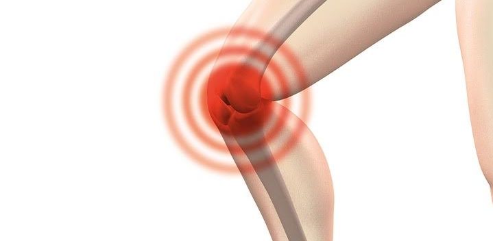 **Gift für die Gelenke // Diese 5 Risikofaktoren solltest du beachten!